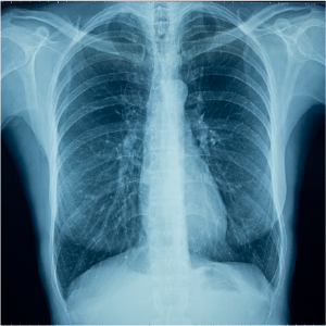 X-Ray Photo